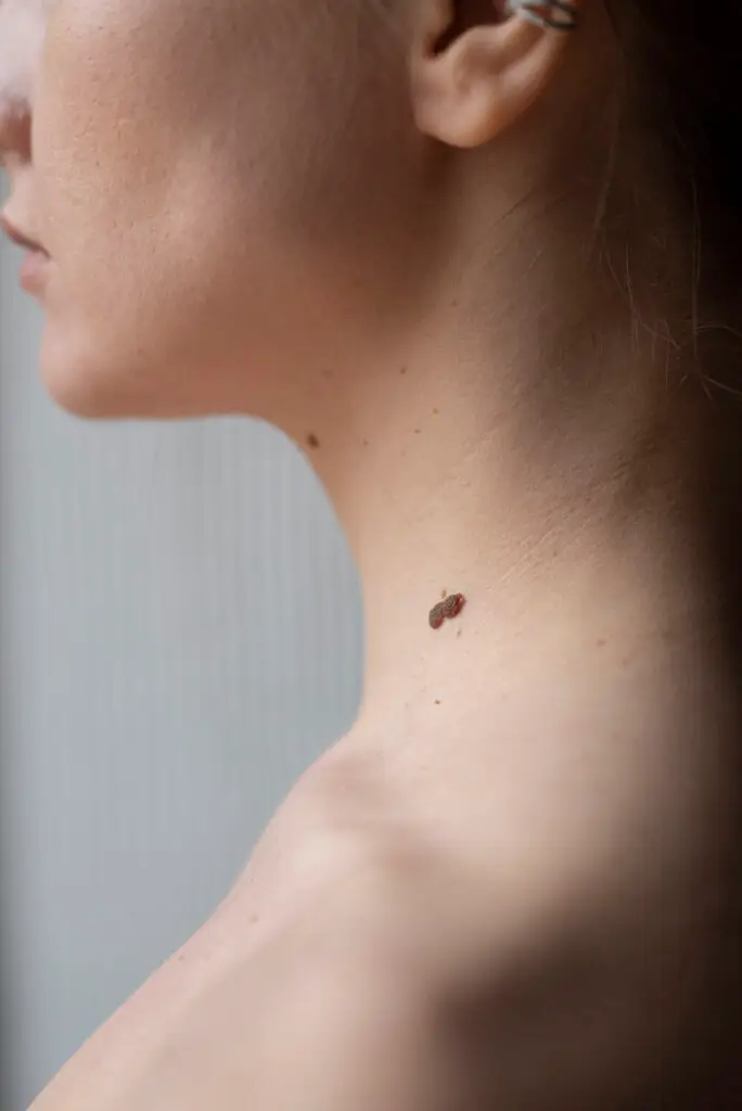 Skin Cancer Assessment with 3D Imaging